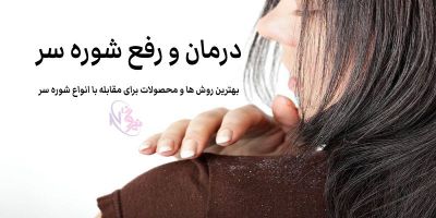 شوره سر چیست؟ | دلایل و روش های درمان و رفع شوره سر